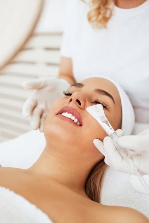 Chemical Peel